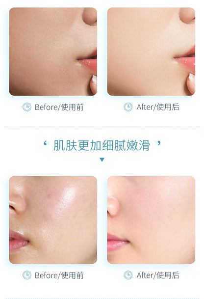 300ml Hyaluronic Acid Hydrating Mineral Spring Hydrating Spray Deep Moisturizing Emollient Refreshing Oil Control Gentle Repair