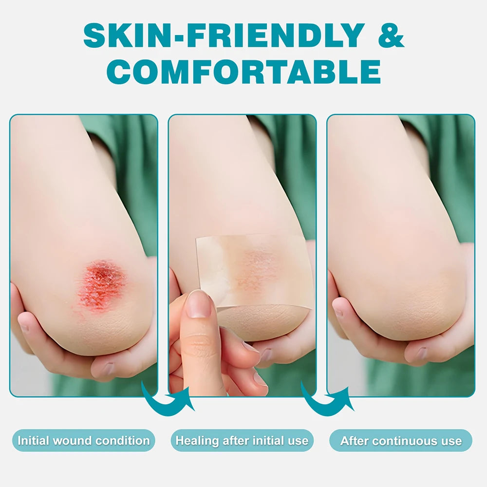 Hydrocolloid Roll Self-Adhesive Hydrocolloid Patch Bandage For Wound Care Bed Sore Bandages Hydrocolloid Gel Waterproof Patches