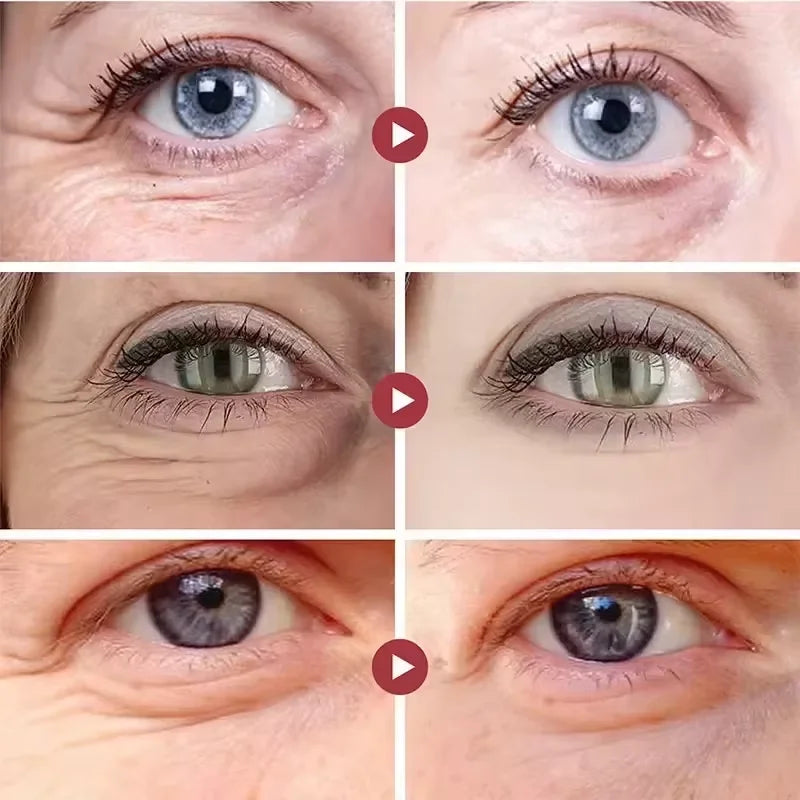 Instant Eye Bag Remove Cream Retinol Anti-Wrinkle Firming Skin Fade Fine Lines Anti Dark Circle Puffiness Brighten Eye SkinCare