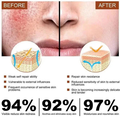 Repair Facial Redness Cream Instant Spider Vein Remove Sensitive Skin Sooth Anti Redness Rosacea Treat Lotion Korean Cosmetics