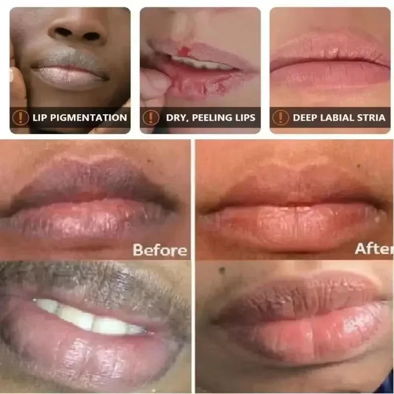 Fast Remove Dark Lip Balm Lighten Melanin Lip Mask Exfoliating Fade Lip Lines Dead Skin Moisturizing Brighten Repair Lip Care