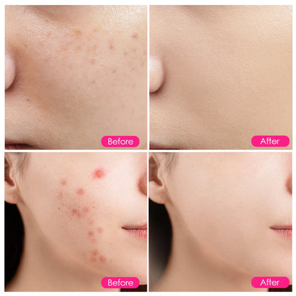 LED Red Light Photon Therapy Face Mask Beauty Instrument Facial SPA Acne Wrinkle Removal Skin Rejuvenation Anti Age Device