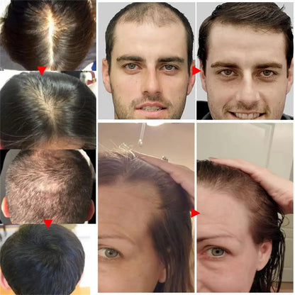 Ginger Hair Growth Serum Spray Anti Loss Regrowth Hair Growth Oil Essence Scalp Massage Moisturizing Nourish Hair Care Men Women