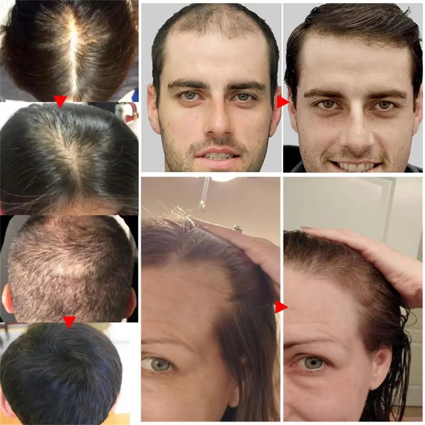 Ginger Hair Growth Serum Spray Anti Loss Regrowth Hair Growth Oil Essence Scalp Massage Moisturizing Nourish Hair Care Men Women