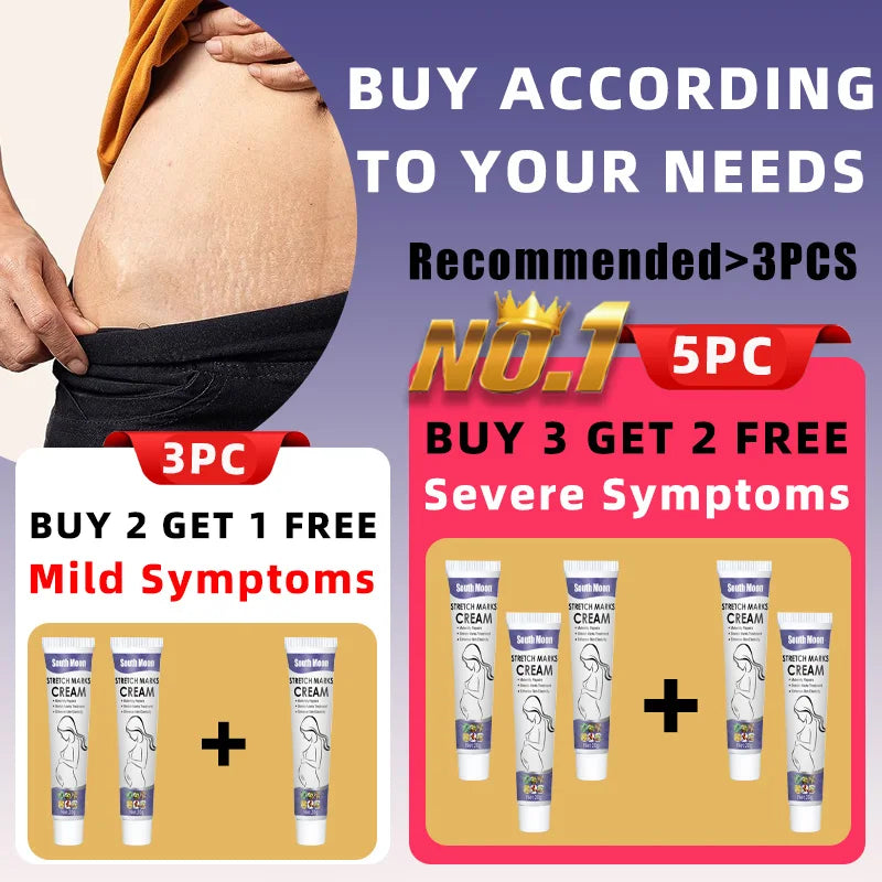 Stretch Mark Repair Cream For Pregnant Women Postpartum Care Firm Light Lines Obesity Lines Growth Lines Repair Cream