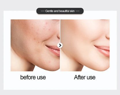 a 500ml  Large Capacity Essence Water Niacinamide Improve Dull Hyaluronic Acid Moisturize Dry Skin Facial Beauty Care Toner