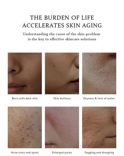 BELYN BERLY Niacinamide Serum for Face 3PCS Brighten Dark Spots Freckle Hyaluronic Acid Moisturizing Facial Serum Skin care