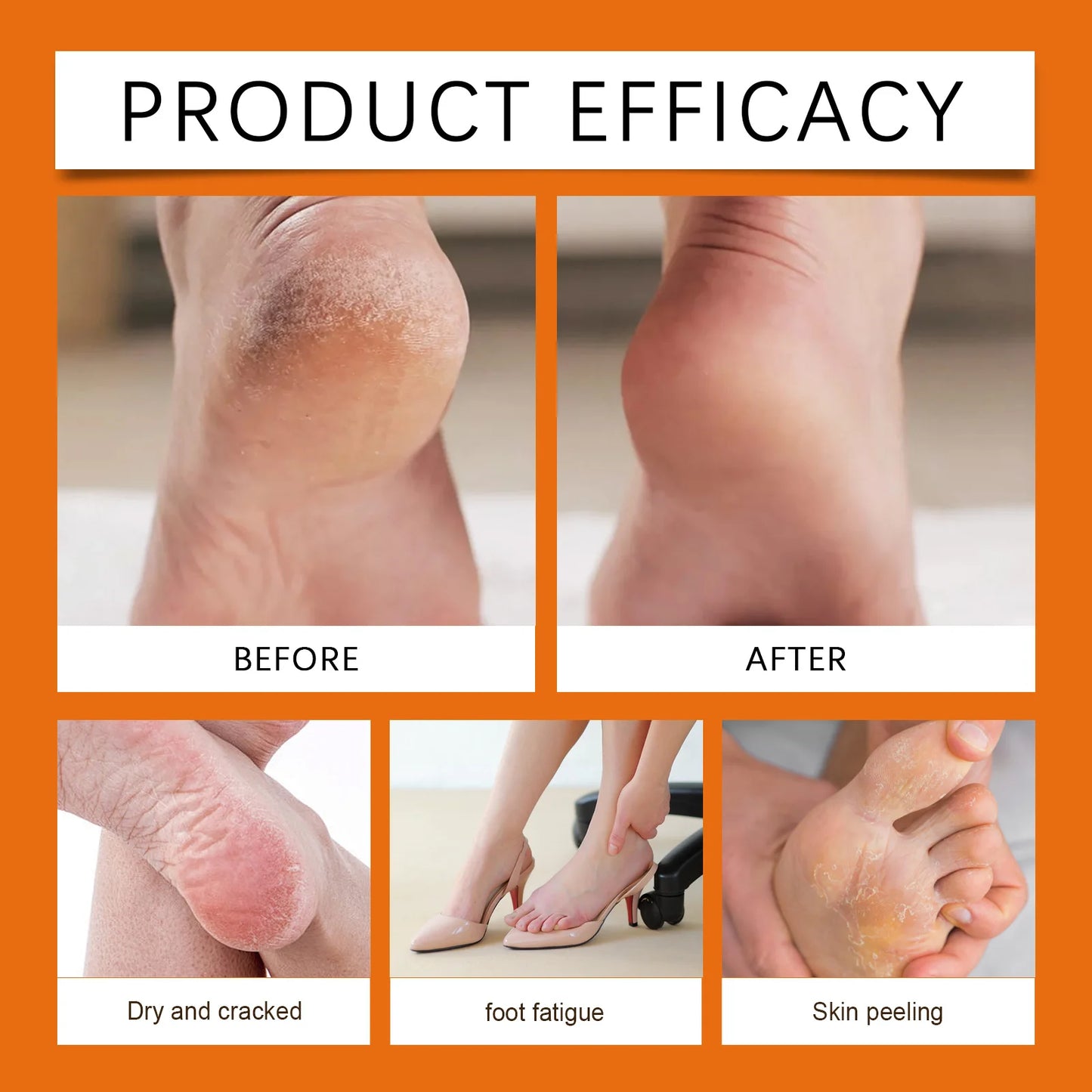 Honey Foot Care Cream Stick Nourishing Balm for Dry Cracked Feet Heel Exfoliation Softening Skin Ultra-Hydrating Hand Foot Balm
