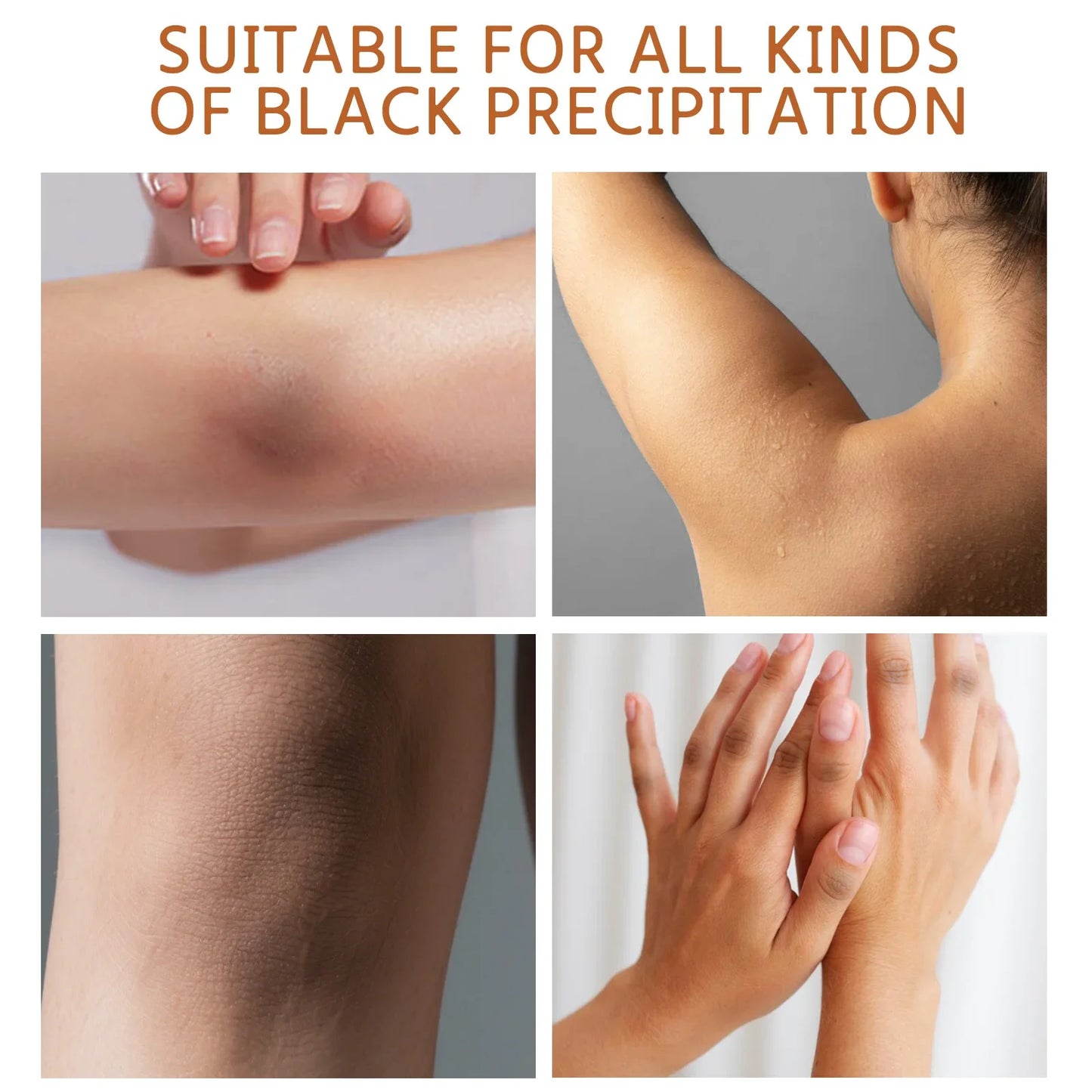 Dark Knuckle Wh-itening Cream Brighten Moisturizing Remover Pigmentation Brightening Knees Skin Care Bleaching Cream
