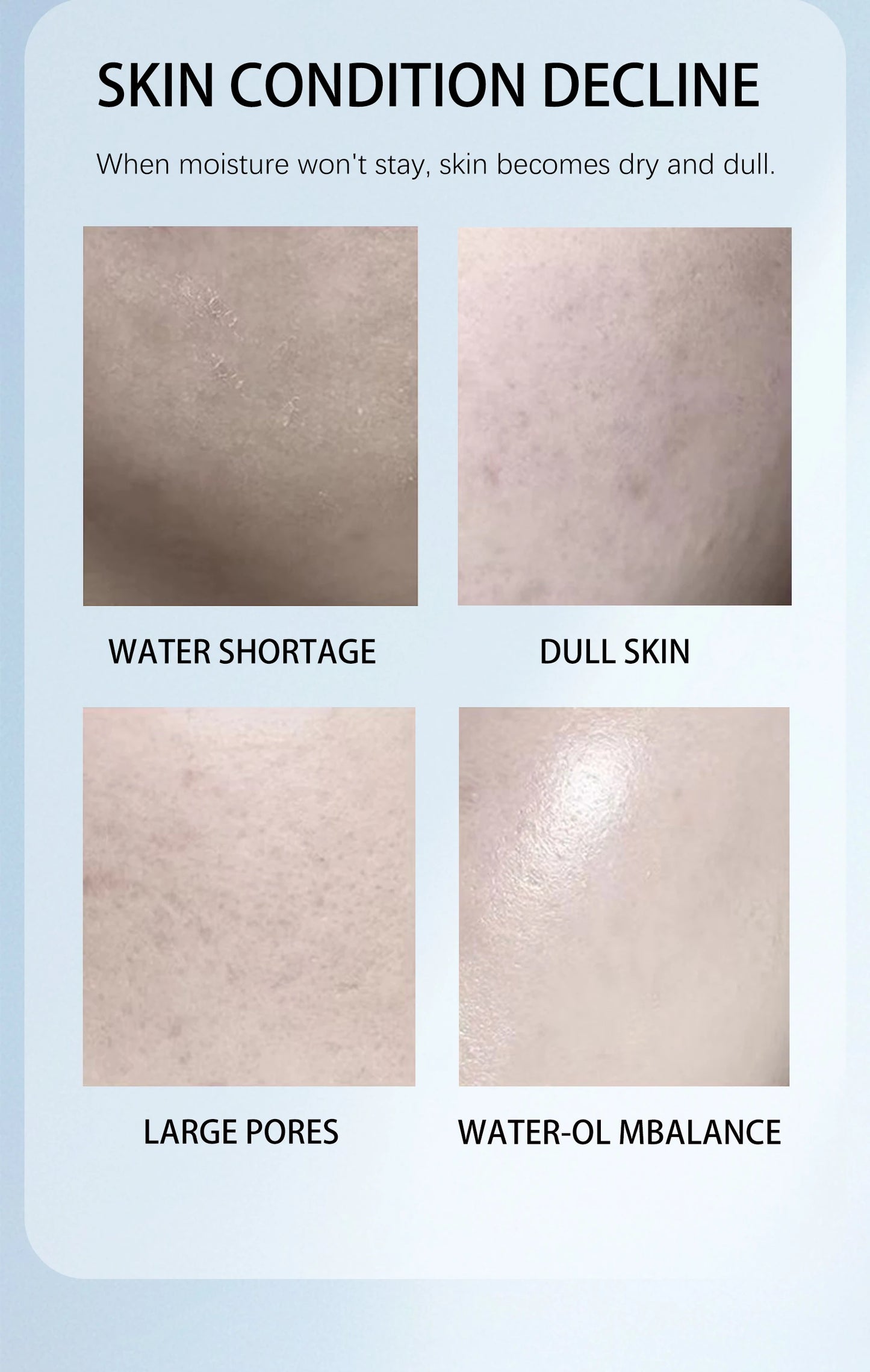 Niacinamide face cream, minimizes pores, moisturizes, suitable for oily skin, effectively hydrates.