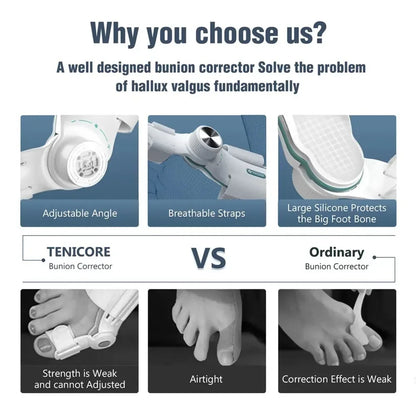 New Bunion Corrector Hallux Valgus Orthotics Big Toe Homing Straightener Adjustable Knobs With 3 Angle Fixing Plate Foot Care