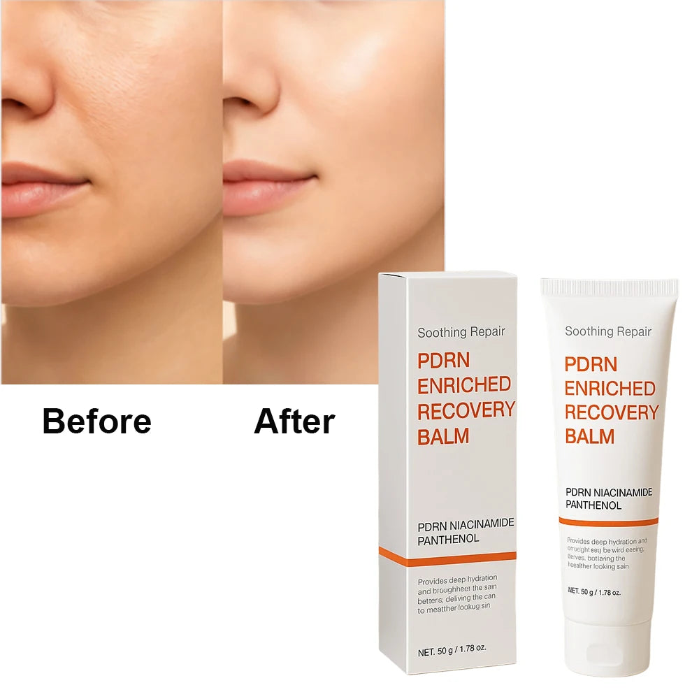 Soothing Repair PDRN Enriched Recovery Balm with Niacinamide & Panthenol, Deep Hydration & Skin Barrier Repair, 50g Face Balm fo