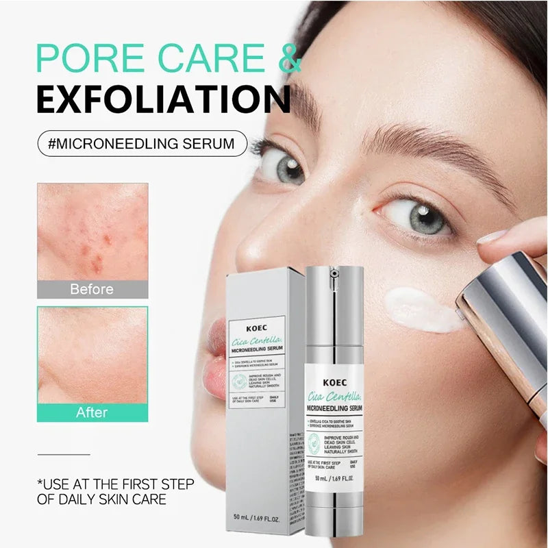 Korean Centella Asiatica Extract Soothes Moisturize Soft Firm Brighten Repair Skin Facial Collagen Microneedle Essence Lotion