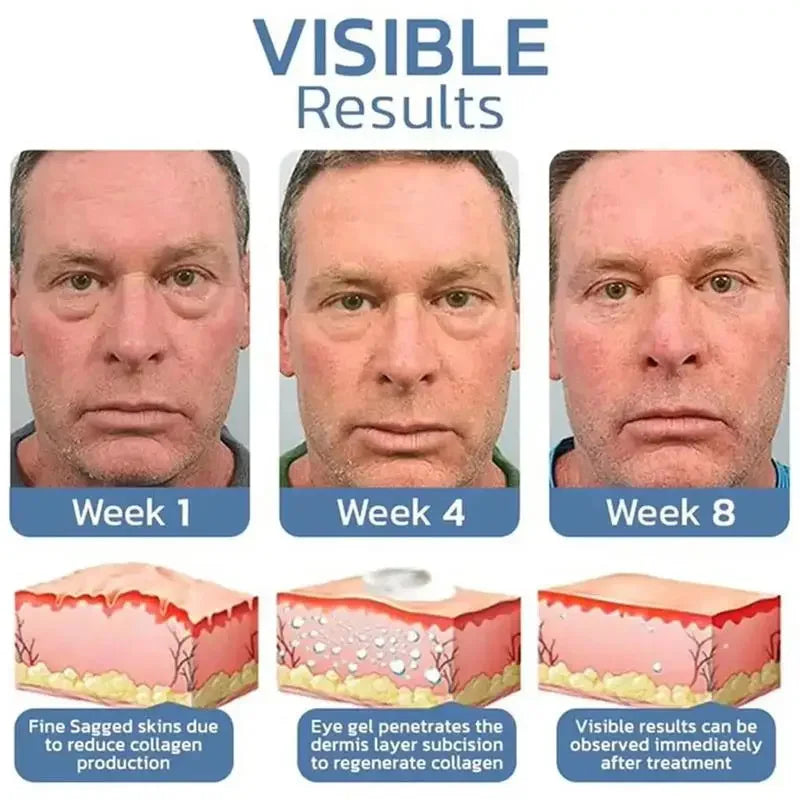 Instant Eye Bag Removal Cream Collagen Anti-Wrinkle Firming Skin Fade Fine Lines Anti Dark Circle Puffiness Brighten Eye Care