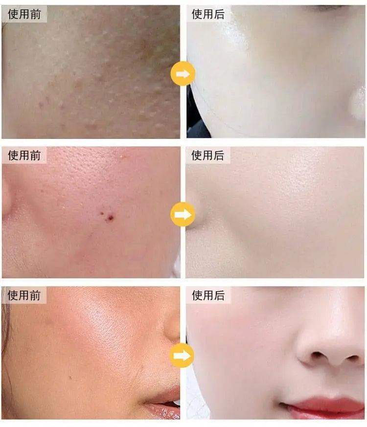 100ml 24k gold foil essence anti wrinkle lifting and firming essence pore shrinking essence skin care product