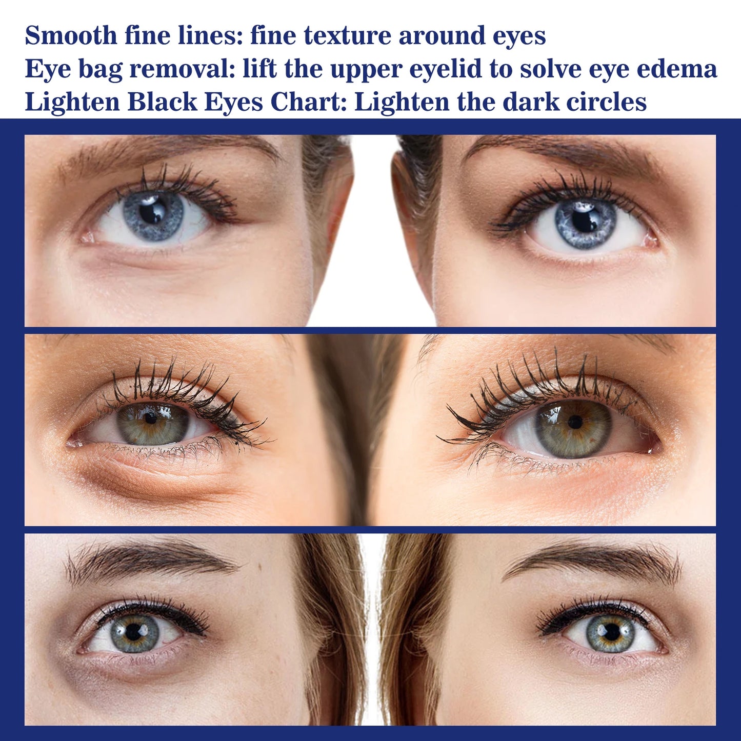 Anti Aging Eye Cream with Hyaluronic Acid Fade Fine Lines Remove Dark Circles Puffiness Moisturizing And Firming for Eye Bags