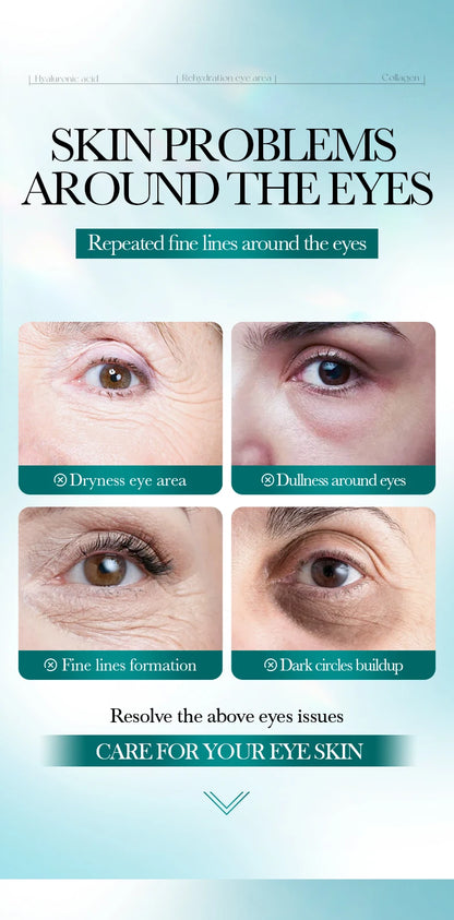80pcs BIOAQUA Crystal Collagen Eye Mask Anti Dark Circles Anti-Wrinkles Moisturizing Whitening Anti-Aging Retinol Eye Patches
