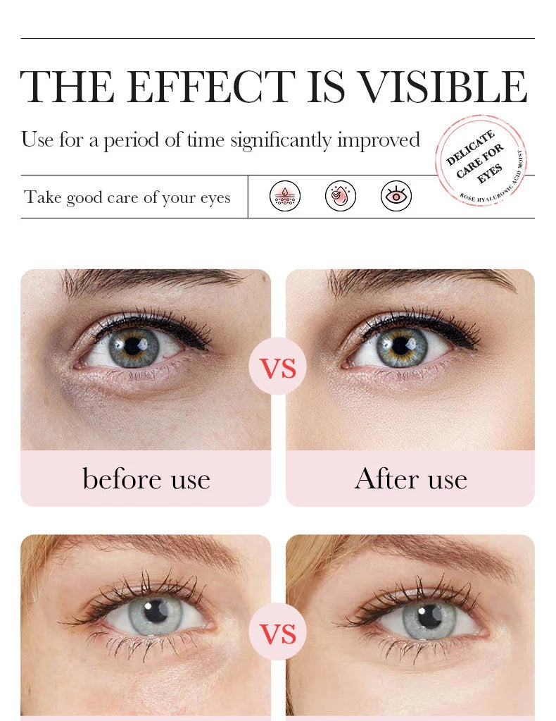 60pcs BIOAQUA Rose Hyaluronic Acid Eye Mask Anti Dark Circles Eye Bags Moisturizing Anti-Aging Eye Patches Skin Care Products