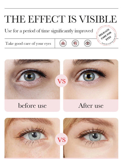 60pcs BIOAQUA Rose Hyaluronic Acid Eye Mask Anti Dark Circles Eye Bags Moisturizing Anti-Aging Eye Patches Skin Care Products