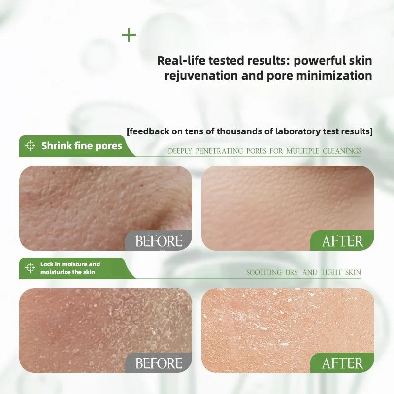 Rosemary Hydrosol essence Moisturizing Serum Fade Fine Lines Facial Moisturizing brightning Anti Aging Firming Skin Care