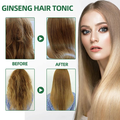 Ouhoe Ginseng Hair Growth Serum 100ml Nourish Scalp Bioactive Formula Promote Hair Regrowth Reduce Hair Fall Strengthen Roots