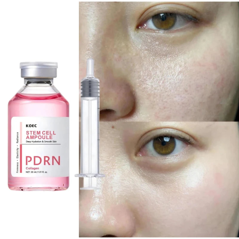 PDRN & Collagen Stem Cell Ampoule Deep Hydration Smooth Skin Enhance Skin Elasticity Nourishing Firming Facial Serum