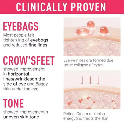 Instant Eye Bag Remove Cream Retinol Anti-Wrinkle Firming Skin Fade Fine Lines Anti Dark Circle Puffiness Brighten Eye SkinCare