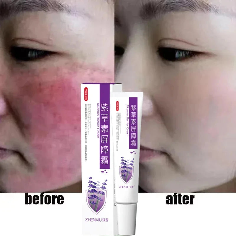 Repair Facial Redness Cream Instant Spider Vein Remove Sensitive Skin Sooth Anti Redness Rosacea Treat Lotion Korean Cosmetics