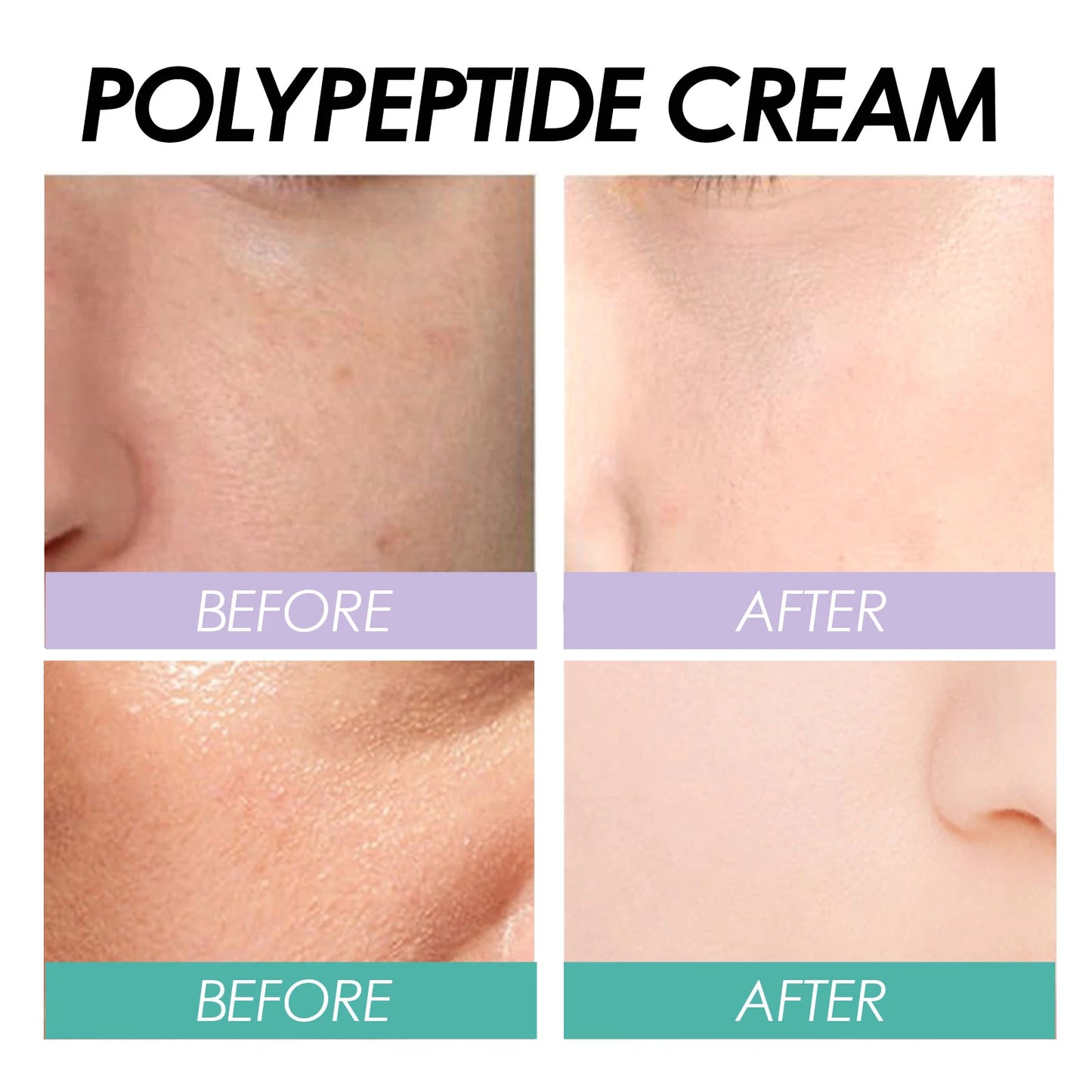 Sheep Placenta Firming Serum Cream Moisturizing To Improve Dull Korean Skin Care Products Asian Facial Care Face Care Nida Cream