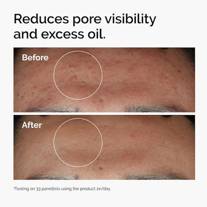 Niacinamide 10% + Zinc 1% Serum 30ml Enhance Skin Brightness Strengthen Skin Moisture Barrier Improve Texture Reduce Excess Oil
