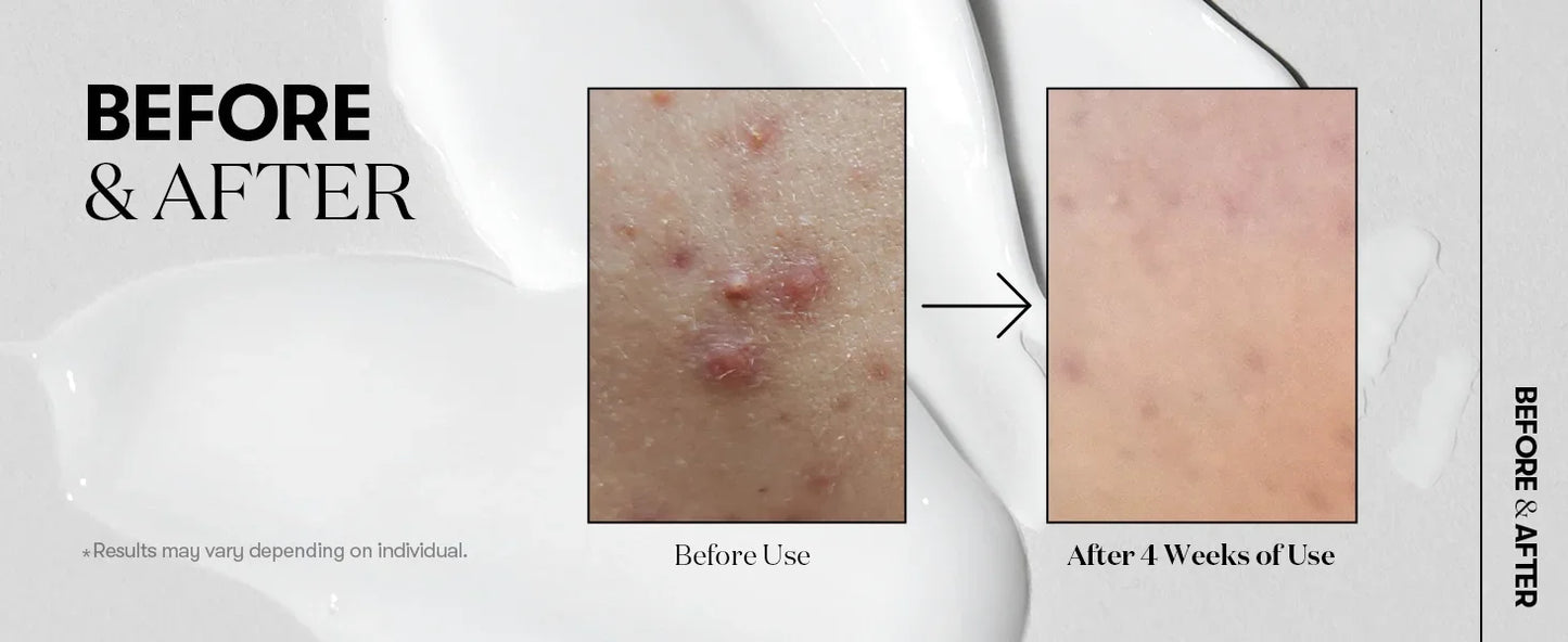 Vt Desalination Of Fine Lines, Collagen Reverse Aging, Recombinant Enhancement , Collagen Solution ,Korean Skincare,50ml