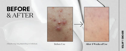 Vt Desalination Of Fine Lines, Collagen Reverse Aging, Recombinant Enhancement , Collagen Solution ,Korean Skincare,50ml