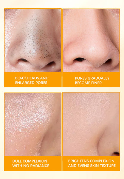 Turmeric and Lemon Deep Cleansing and Pore-Minimizing Clay Mask; Exfoliating and Brightening Clay Mask; Used for Skin Repair.