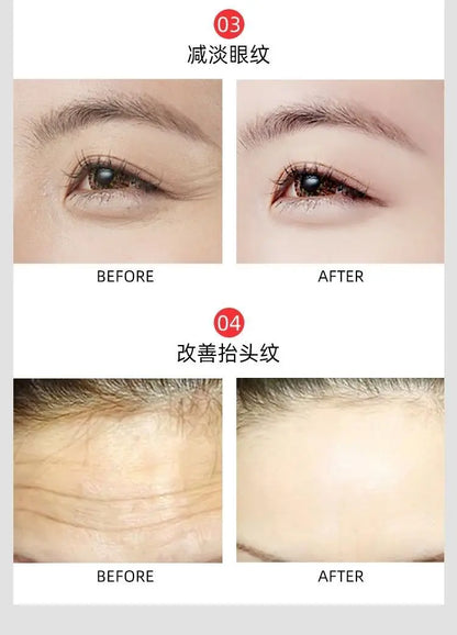 100ml 24k gold foil essence anti wrinkle lifting and firming essence pore shrinking essence skin care product