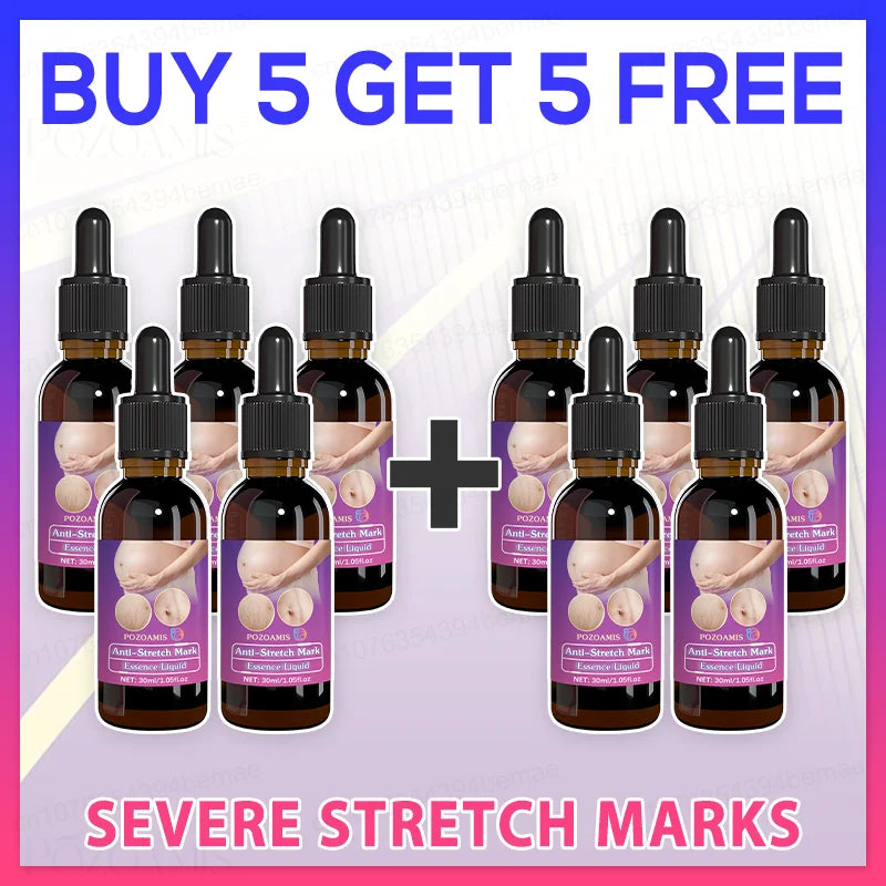 Stretch mark repair, easy removal at home
