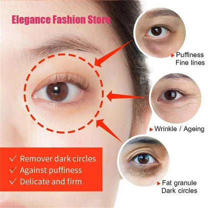 Instant Eye Bag Remove Eye Cream Anti Fat Particles Dark Circles Puffiness Fade Fine Lines Lift Brighten Korean Beauty Eye Care