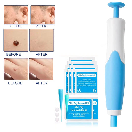 Rubber Rings Skin Tag Removal Device Face Beauty Accessories Remove Skin Wart Kits Multipurpose Supplies for Face Neck Chin Back
