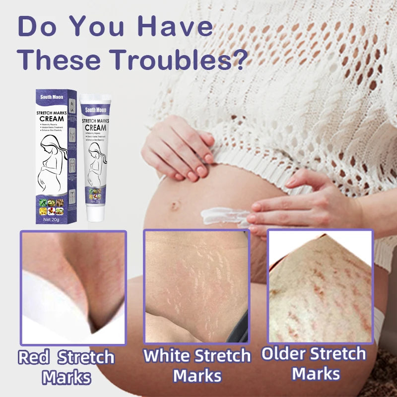 Stretch Mark Repair Cream For Pregnant Women Postpartum Care Firm Light Lines Obesity Lines Growth Lines Repair Cream