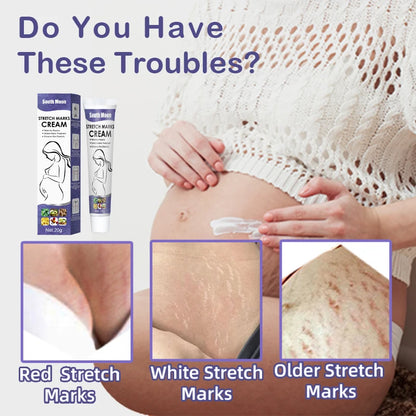 Stretch Mark Repair Cream For Pregnant Women Postpartum Care Firm Light Lines Obesity Lines Growth Lines Repair Cream