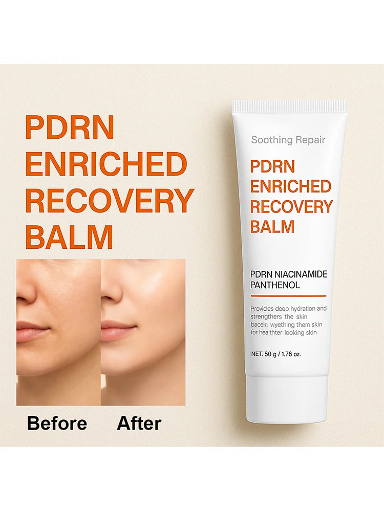 Soothing Repair PDRN Enriched Recovery Balm with Niacinamide & Panthenol, Deep Hydration & Skin Barrier Repair, 50g Face Balm fo