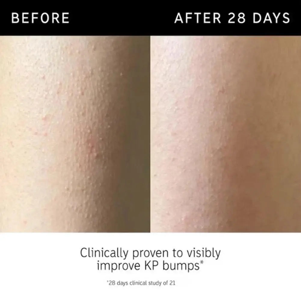 Korean Gentle Deep Cleansing Exfoliating Gel - Remove Blackhead Shrink Pores Whiten Moisturizing Daily Facial Skincare