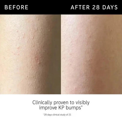 Korean Gentle Deep Cleansing Exfoliating Gel - Remove Blackhead Shrink Pores Whiten Moisturizing Daily Facial Skincare