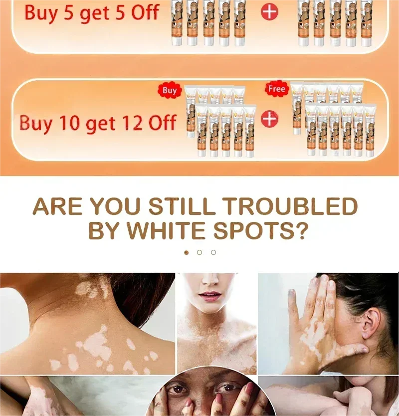 Vitiligo cream, men's and women's skin care essence
