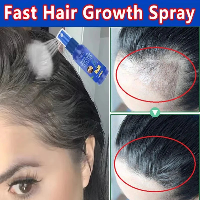 Ginger Hair Growth Serum Spray Anti Loss Regrowth Hair Growth Oil Essence Scalp Massage Moisturizing Nourish Hair Care Men Women