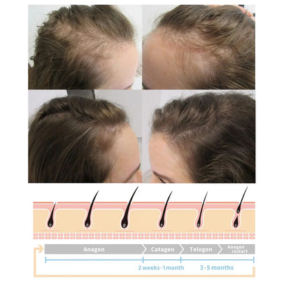 Ginger Hair Growth Serum Spray Anti Loss Regrowth Hair Growth Oil Essence Scalp Massage Moisturizing Nourish Hair Care Men Women