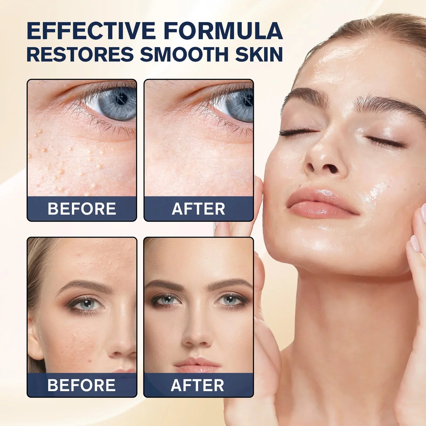 Milia Remover Essence Treatment Fat Granule Clearing Skin Hyaluronic Acid Deep Hydration and Gentle Exfoliation Hydrates Smooths
