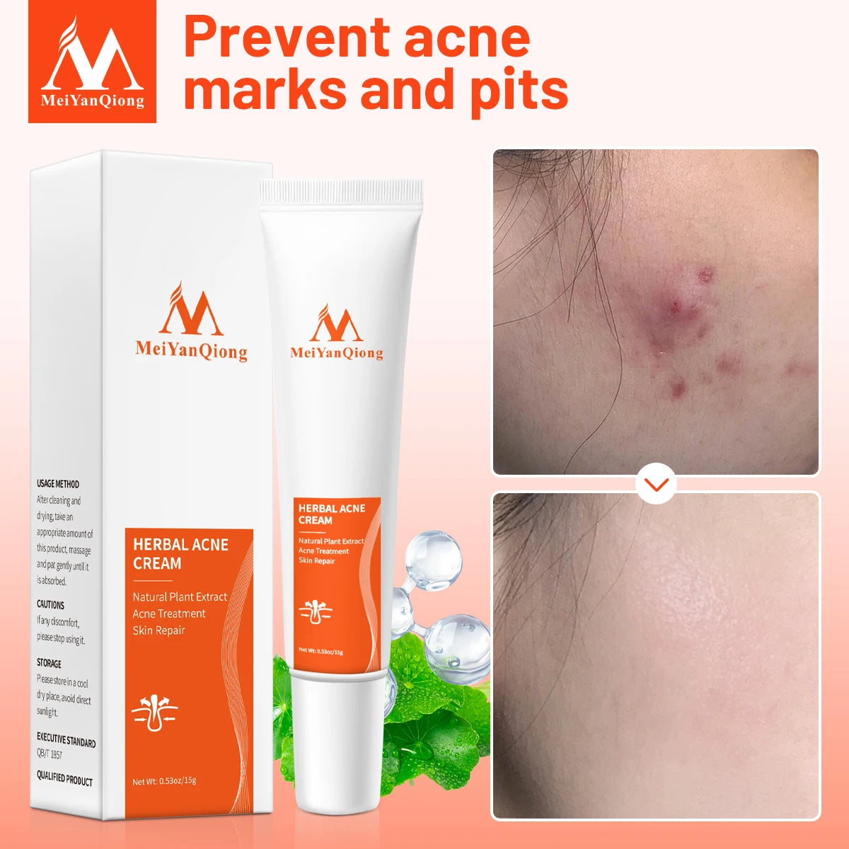 Acne Cream Acne Removal Eliminate Acne Marks Repair Damaged Skin Moisturizing Nourishing Whitening Skin Rejuvenating Face Care