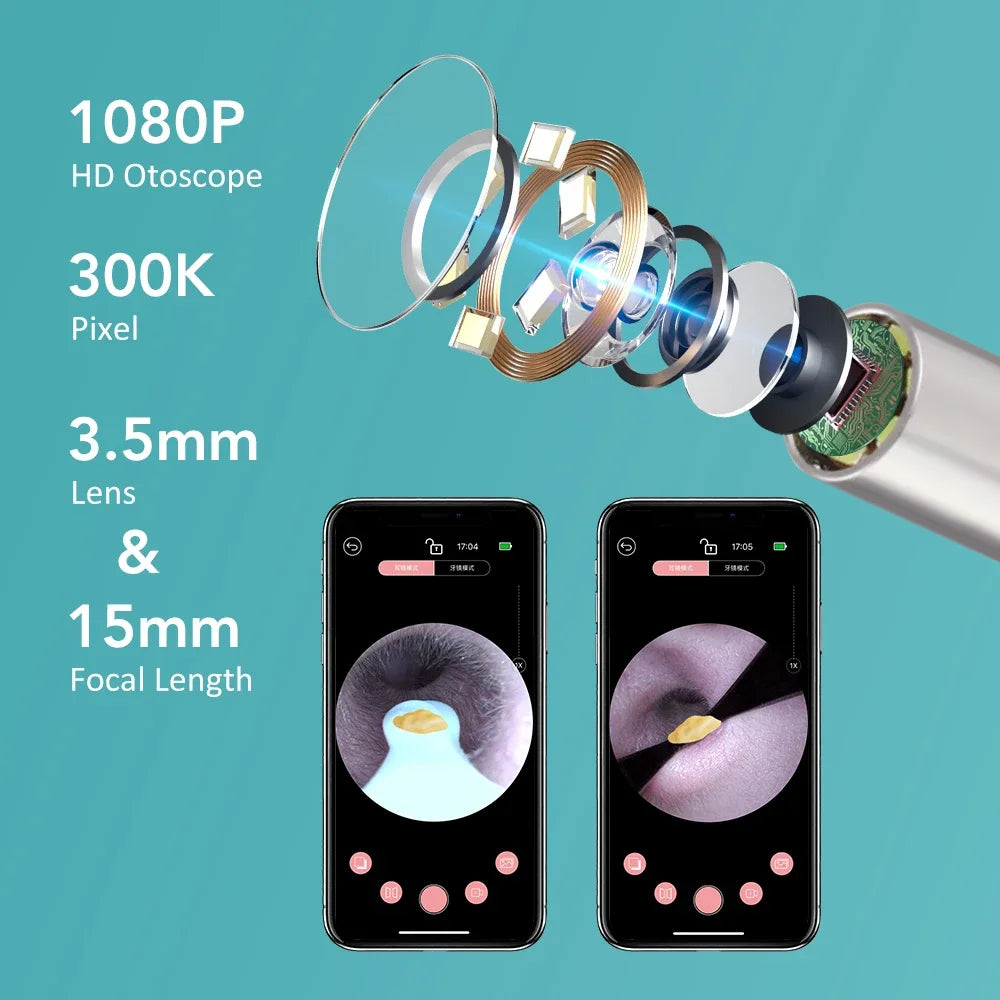 2 in 1 Smart Visual Ear Wax Cleaner With Camera 1080P HD Endoscope Multi-Functional 3.5mm Mini Visual Earpick Ear Cleaning Tool
