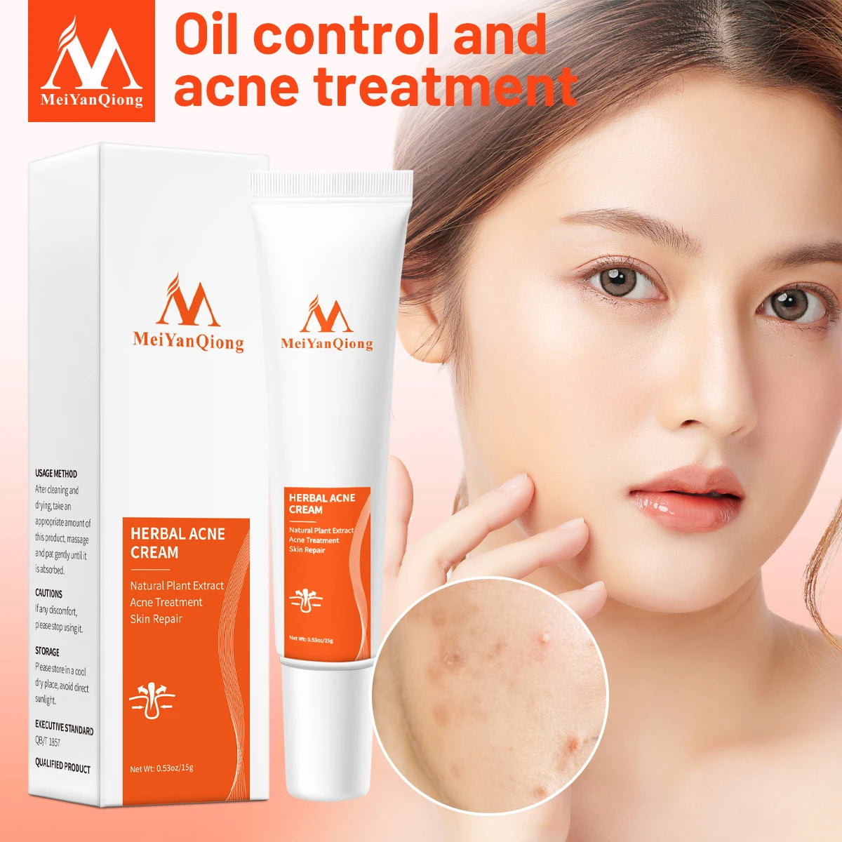 Acne Cream Acne Removal Eliminate Acne Marks Repair Damaged Skin Moisturizing Nourishing Whitening Skin Rejuvenating Face Care
