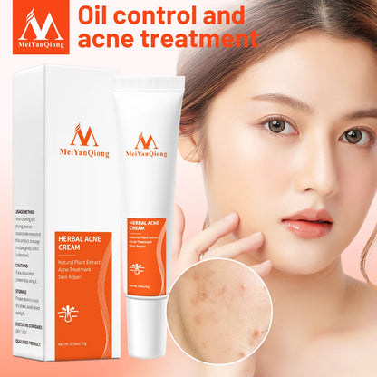 Acne Cream Acne Removal Eliminate Acne Marks Repair Damaged Skin Moisturizing Nourishing Whitening Skin Rejuvenating Face Care